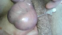 Aiguilles dans les testicules