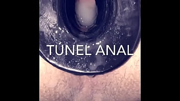 Anal tunnel