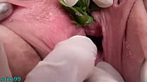 Brennnesseln in Peehole Urethral Insertion Brennnesseln & Fisting Cunt