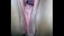 Vagina aberta