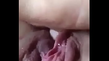 Vagina jugosa